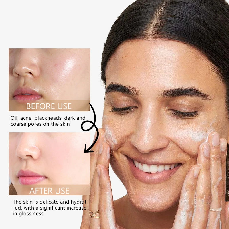 Low PH 150Ml Facial Cleanser Gentle Oil Control Moisturizing Face Wash Whitening Facial Foam Exfoliating Deep Remove